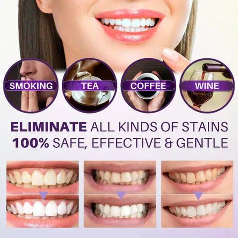 HISMILE V34 INSTANT TEETH WHITENER